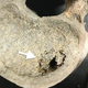 The white arrow points to suspected cancer metastases from the spine of a skeleton unearthed from a medieval cemetery.